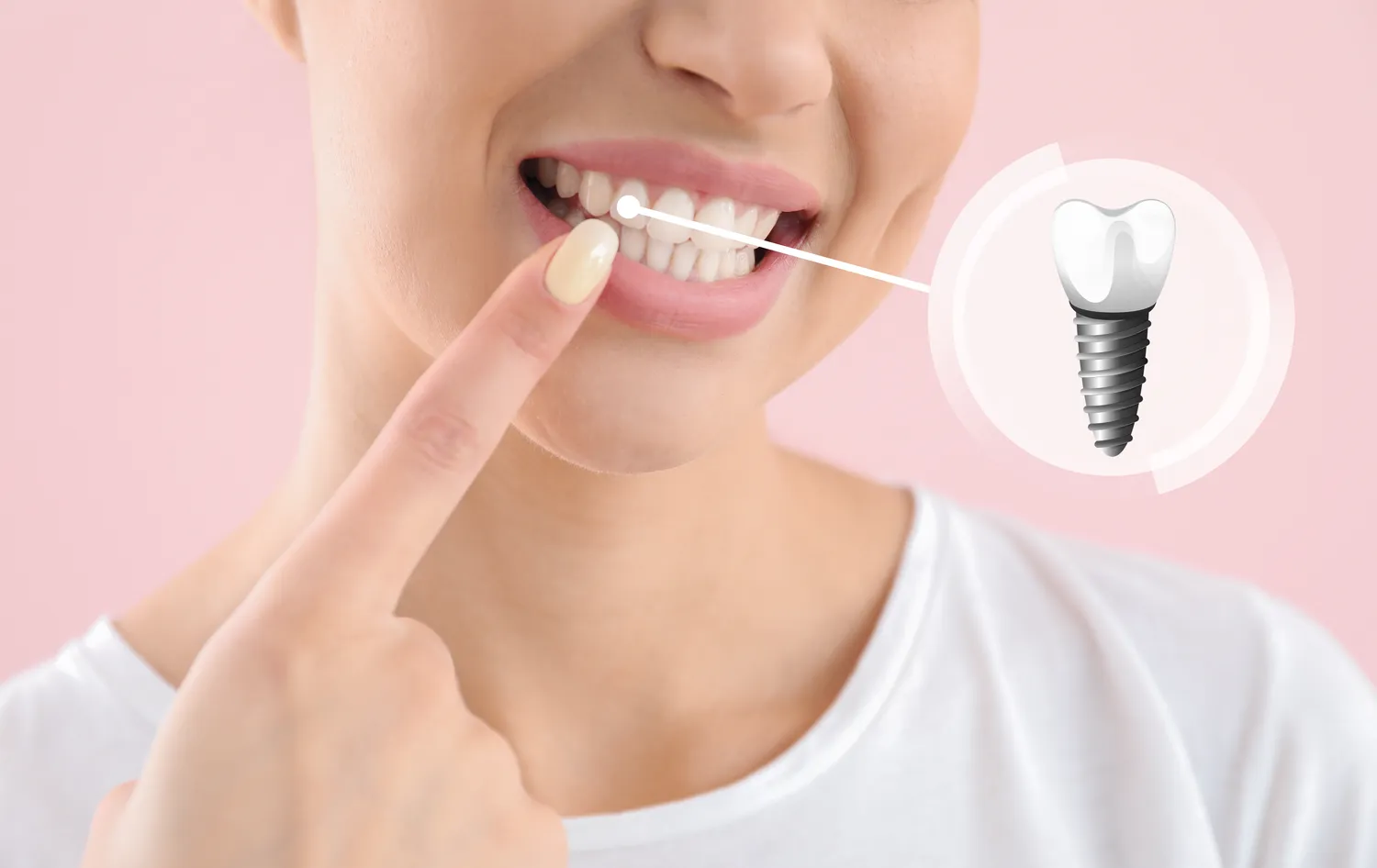 Najlepsza endodoncja Szczecin